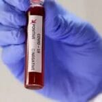 Боротьба з коронавірусом: терапія пацієнтів з Covid-19