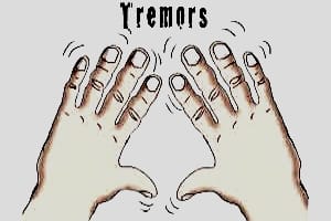 Тремтіння рук: 3 причини
