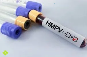 Метавірус